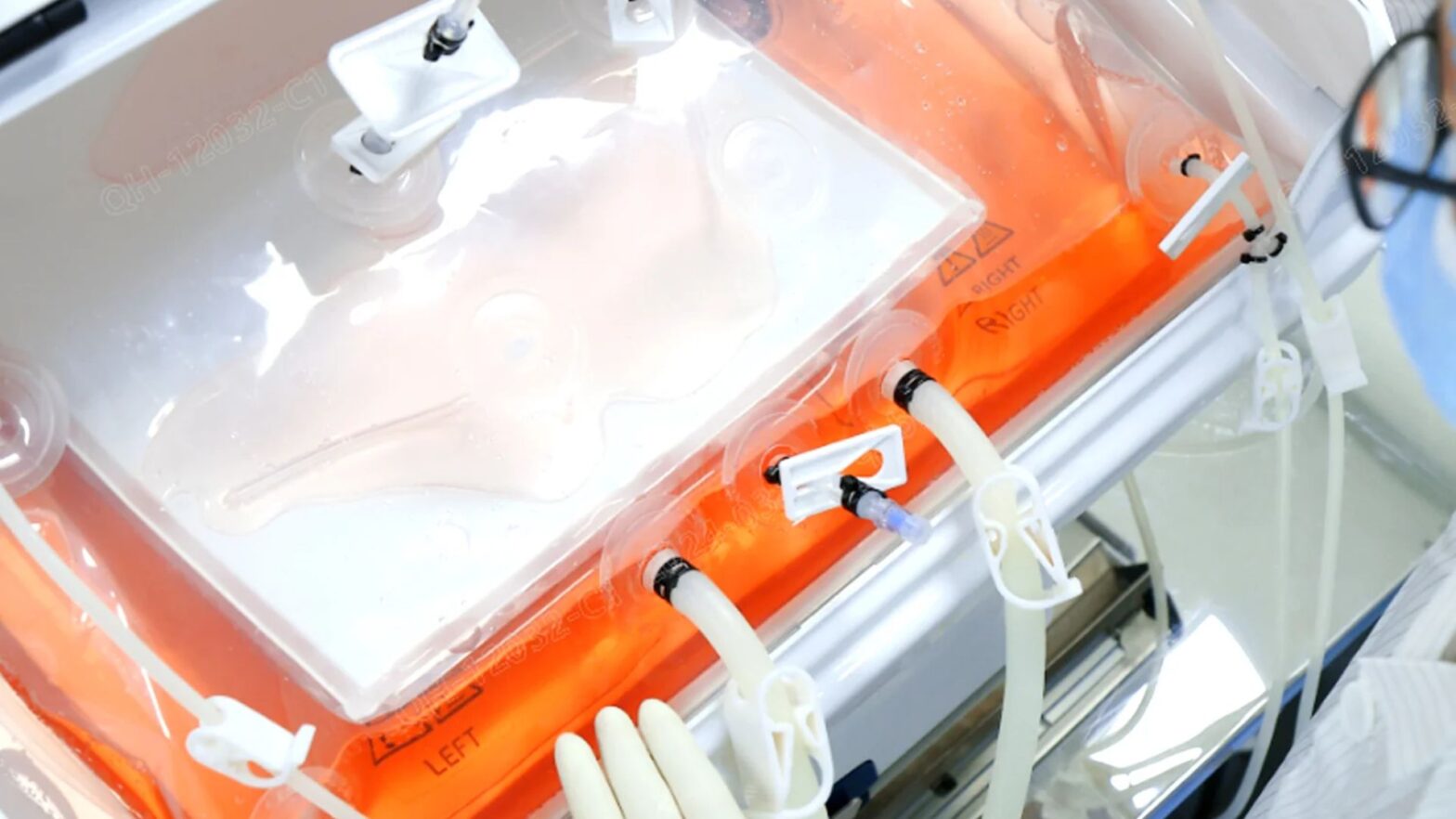 Lab Filters in Australia: Supporting Advanced Bioprocessing with Single-Use Technologies