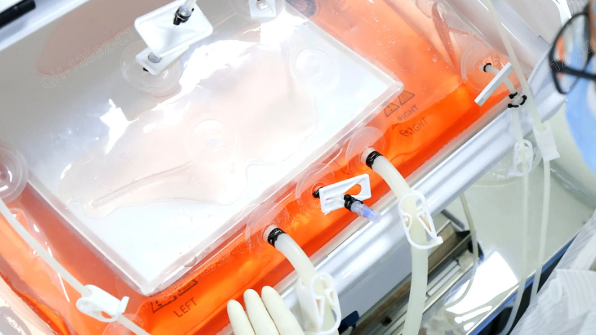 Lab Filters in Australia: Supporting Advanced Bioprocessing with Single-Use Technologies